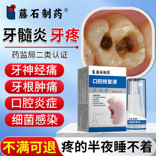 牙髓炎牙神经疼痛专用喷剂漱口水牙龈萎缩消炎非牙膏药房同售SK