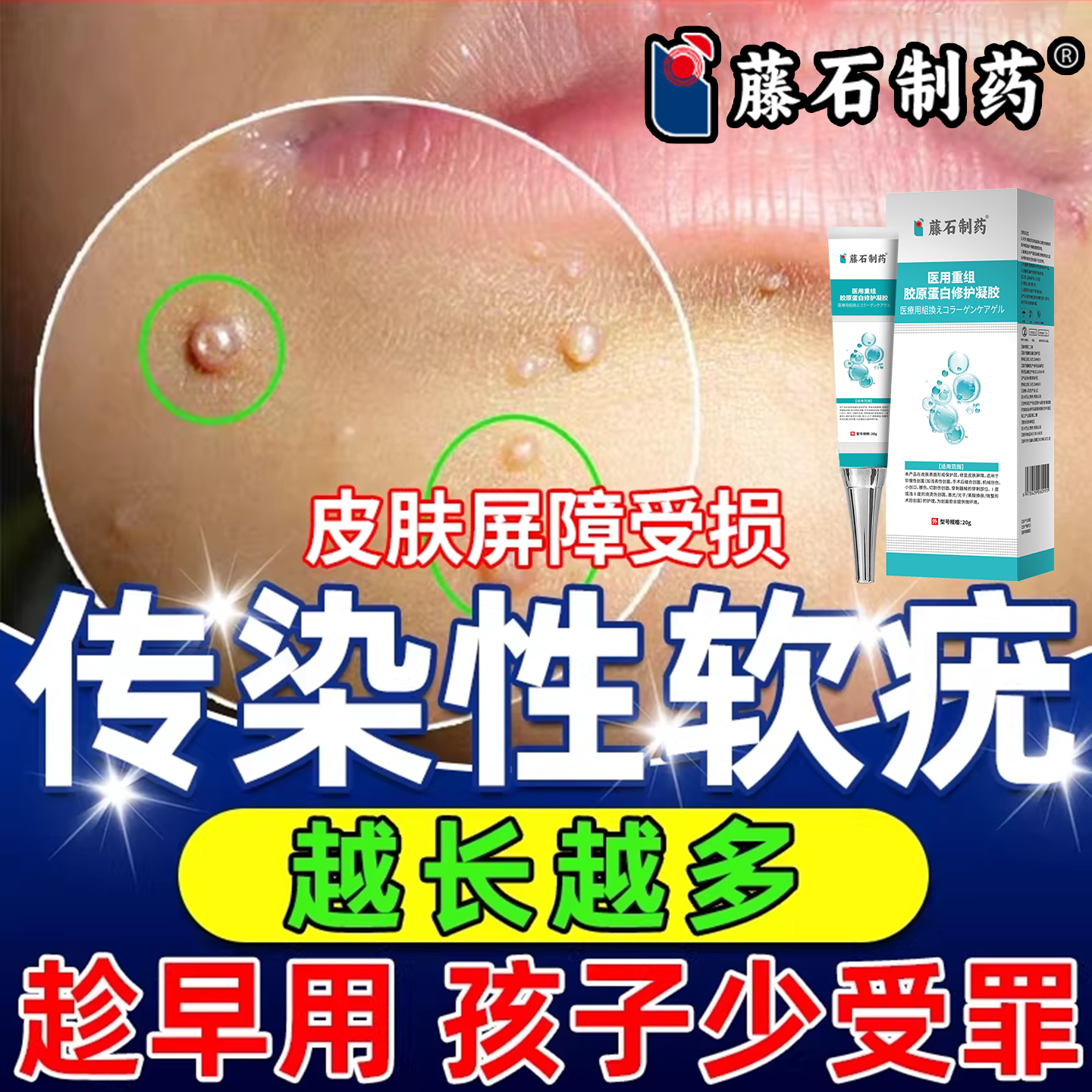 传染性软疣儿童水猴子点疣水医用祛疣瘊丝状疣扁平疣去小肉粒CA