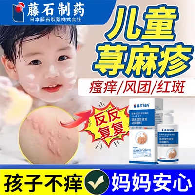 儿童荨麻疹沐浴露断过敏止痒根抑菌皮肤湿疹膏专用去腿窝身体乳js