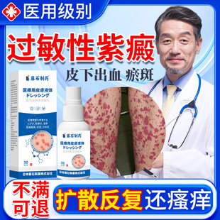 过敏性紫癜皮下出血药房同售膏四肢红点淤堵特皮炎血管炎效SK