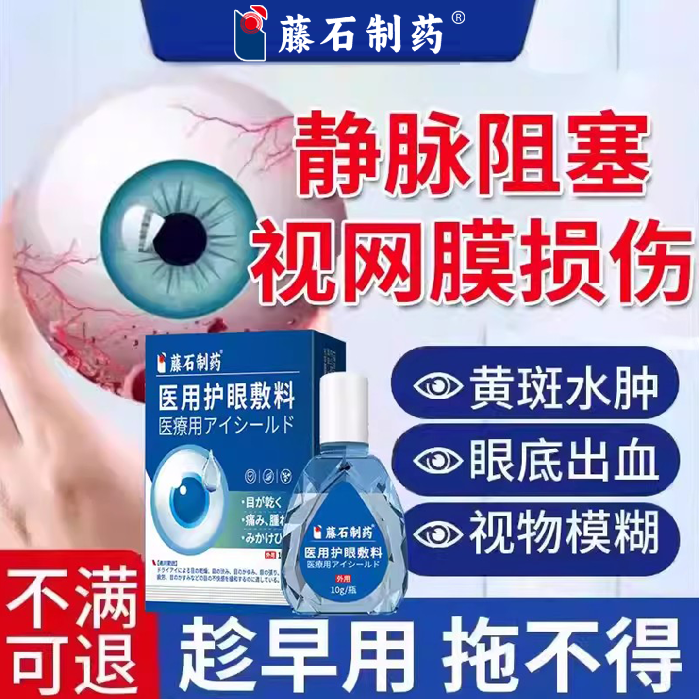 视网膜静脉阻塞眼底黄斑病变出血水肿搭叶黄素眼药水冰敷眼贴CA