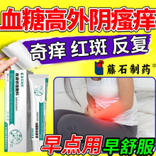 高血糖外阴瘙痒专用止痒抑菌膏私处异味越挠越痒糖尿病皮肤痒SK