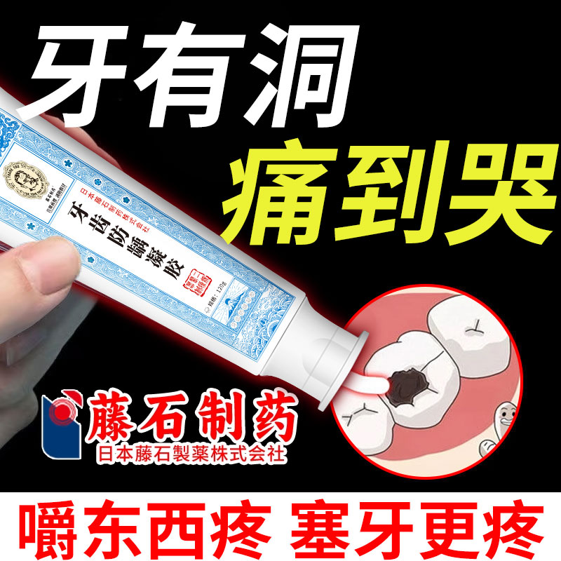 医用儿童搭牙凝胶膏防蛀牙龋齿修6到12岁含氟换牙期防蛀固齿复CA