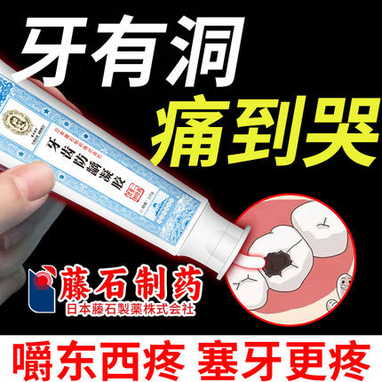 医用儿童搭牙凝胶膏防蛀牙龋齿修6到12岁含氟换牙期防蛀固齿复CA