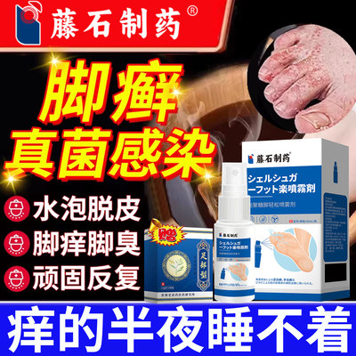 脚癣脚气脚痒脱皮小水泡止痒杀菌去真菌感染可搭泡脚中药包臭脚CA
