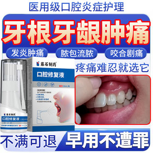 根尖周炎专用喷雾搭牙膏牙齿牙龈肿痛脓包急性牙根尖炎咬合痛SK