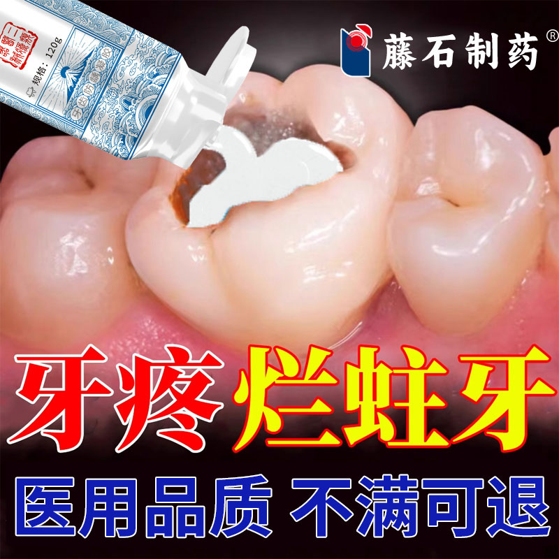 再生硅可搭配牙膏防蛀抗敏含氟成人蛀牙专用牙洞清理牙虫烂牙疼SK