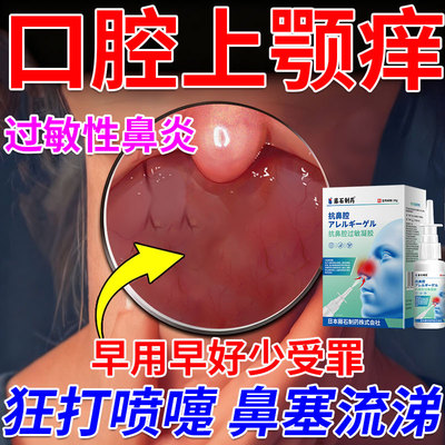 上颚痒过敏性鼻炎喷剂喉咙嗓子干痒异物感上颚发炎肿痛喷雾剂SK
