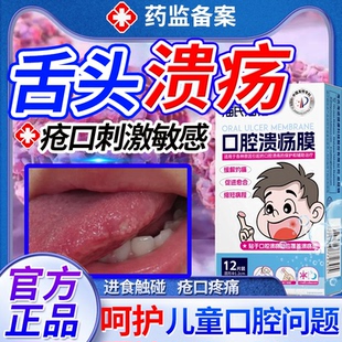 儿童舌间口腔溃疡膜贴舌头溃疡反复专用一点灵舌头疼痛药房同售UC