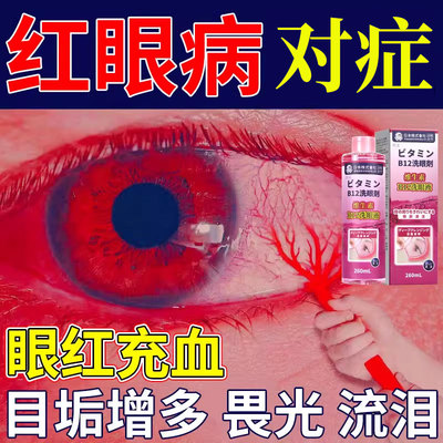 红眼病眼药水止痒消炎杀菌洗眼液