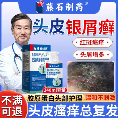 头皮银屑病专牛皮癣用洗发水药房同售头皮屑多真菌感染皮肤瘙痒PG