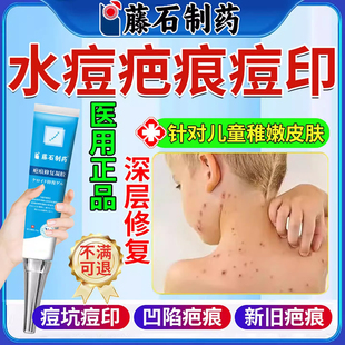 儿童水痘疤痕修复凝胶去水痘坑痘印生长凹陷因子去祛疤膏黑沉淀SK