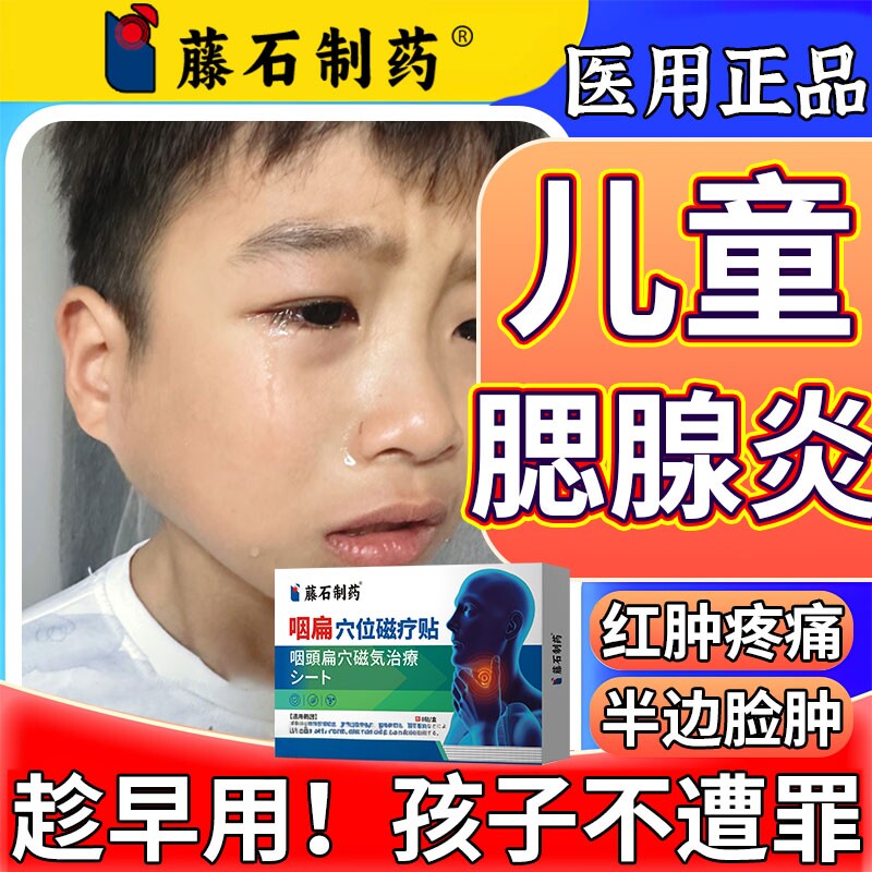 儿童腮腺炎膏药贴消慢性痄腮淋巴结肿肥大散脖子结耳后肿痛神器SK