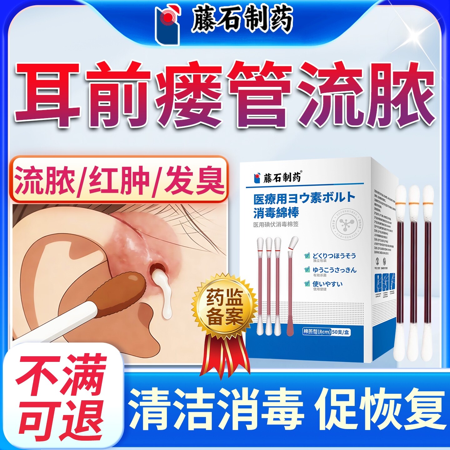 耳前瘘管发炎流脓消毒碘伏棉签医用耳仓清理冲洗可搭药膏贴SK
