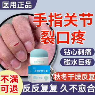 手指开裂口子膏贴药房同售干裂粗糙爆干皮秋冬指缝出血CA