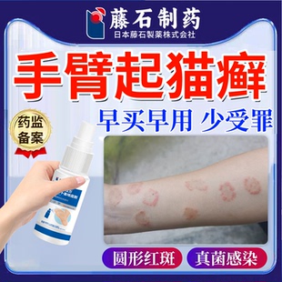 手臂起猫癣人专用得了猫癣药房同售红斑真菌感染体止癣瘙痒喷雾UC