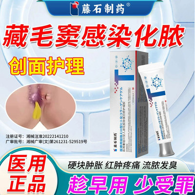 藏毛窦感染化脓脓肿囊肿骶骨尾硬疙瘩坐疮毛囊炎疖肿拔毒拔脓膏SK