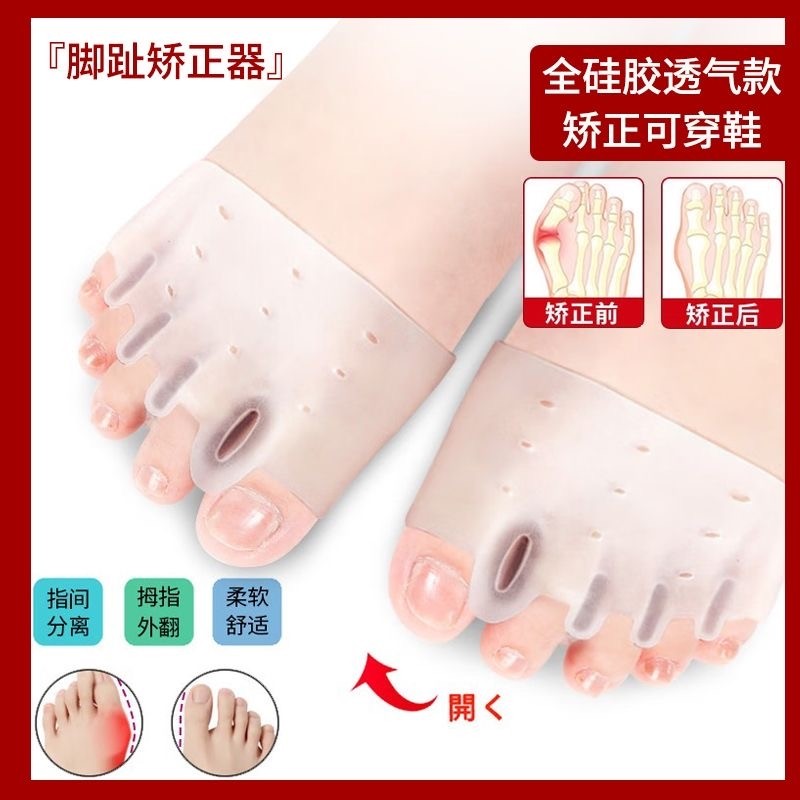 成人脚趾矫正器五指脚趾分离器拇指外翻矫正器硅胶护前掌垫防痛垫