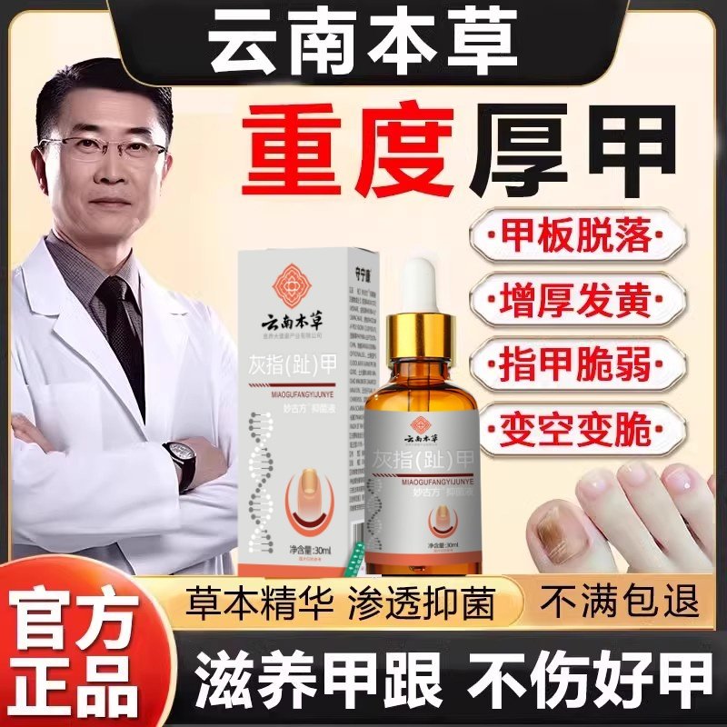 云南本草灰指甲抑菌液甲板脱落增厚发黄浑浊脆弱变脆不平官方正品