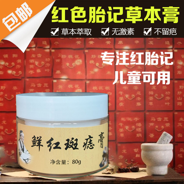 去红胎记药去除鲜红斑痣膏淡化黑色素神器脸部葡萄酒色斑焰色痣膏