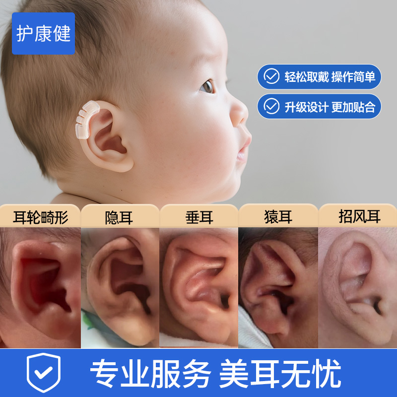 【专业指导】新生宝宝耳朵矫正器