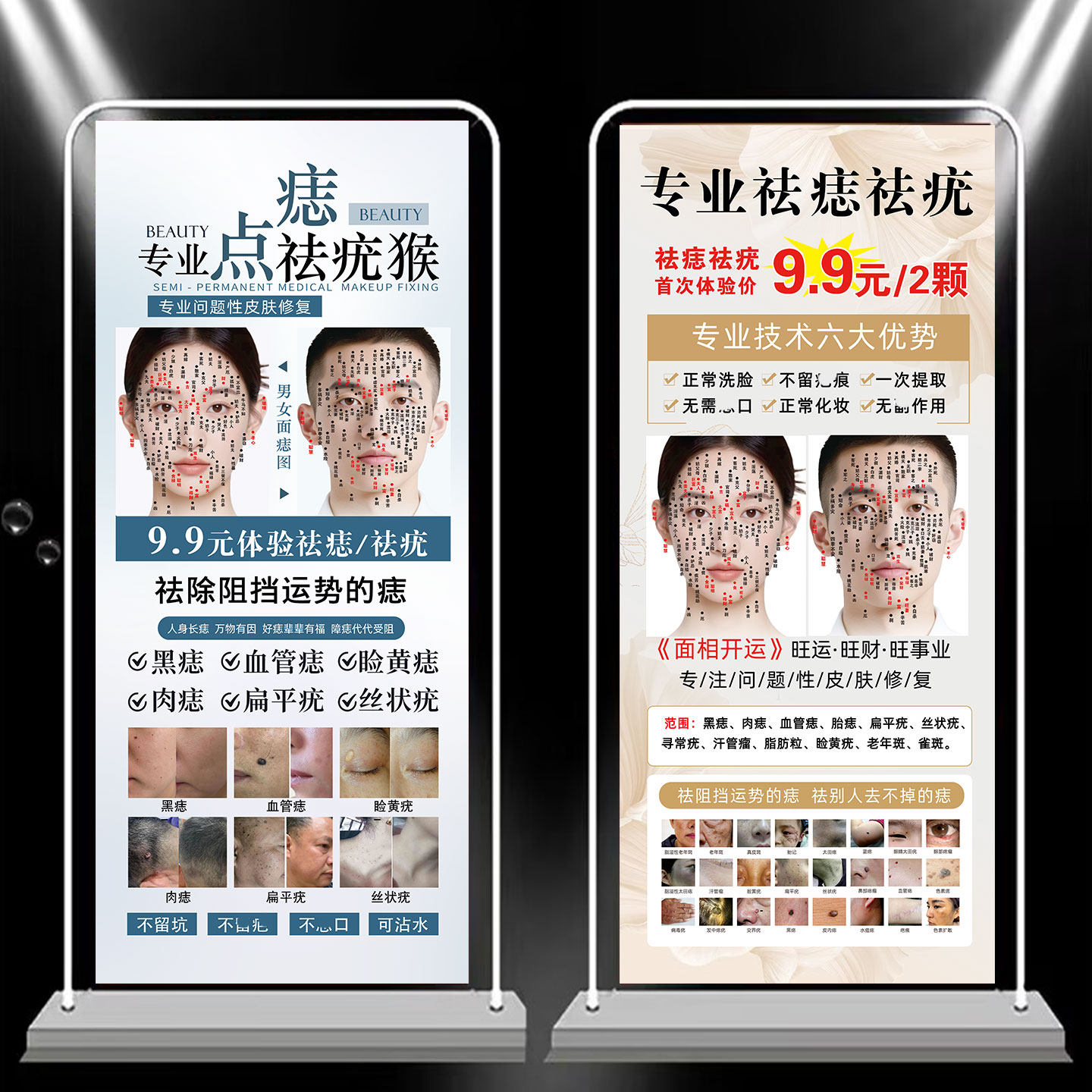 点痣祛痣祛疣展架植物古方祛痣广告宣传面部点痣祛斑宣传图易拉宝