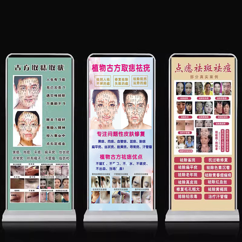 男女点痣图海报面痣中药古方袪痣取疣宣传图专业祛斑祛痘广告展架