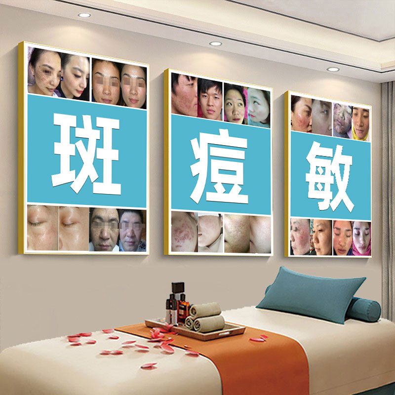 祛斑祛痘广告图皮肤管理挂画护肤图面部点痣图祛痣海报点痣宣传图