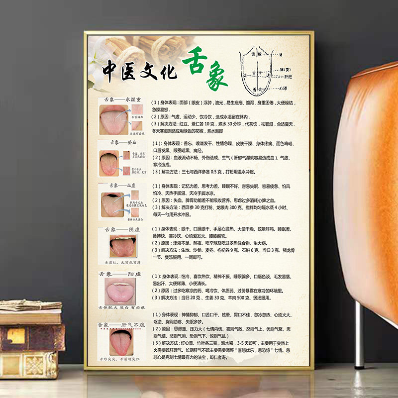舌头反射图健康状况对照表舌诊海报医院挂图中医舌头示意图宣传画