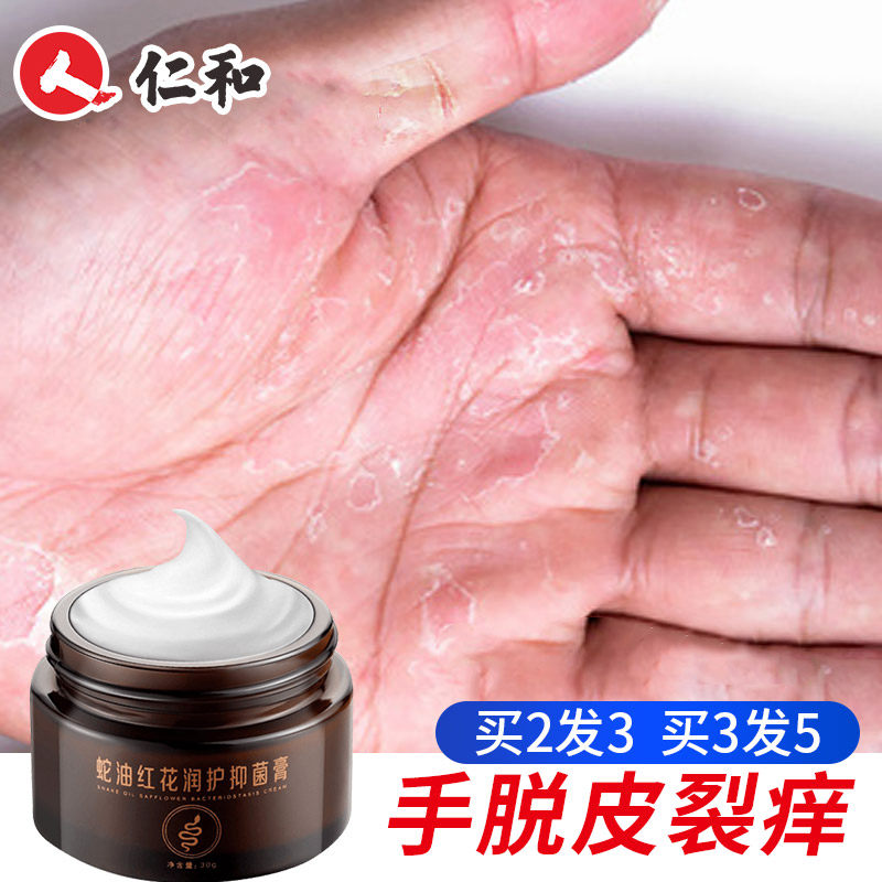 手脱皮霜抑菌膏季节性褪皮手掌严重专用蜕皮裂手上起皮干燥掉皮足