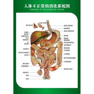 人体不正常的消化系统示意图 内脏分部图人体解剖图医院宣传挂图