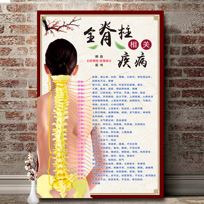 全脊柱相关疾病示意图人体脊柱椎节段神经全息挂图中医养生墙贴画