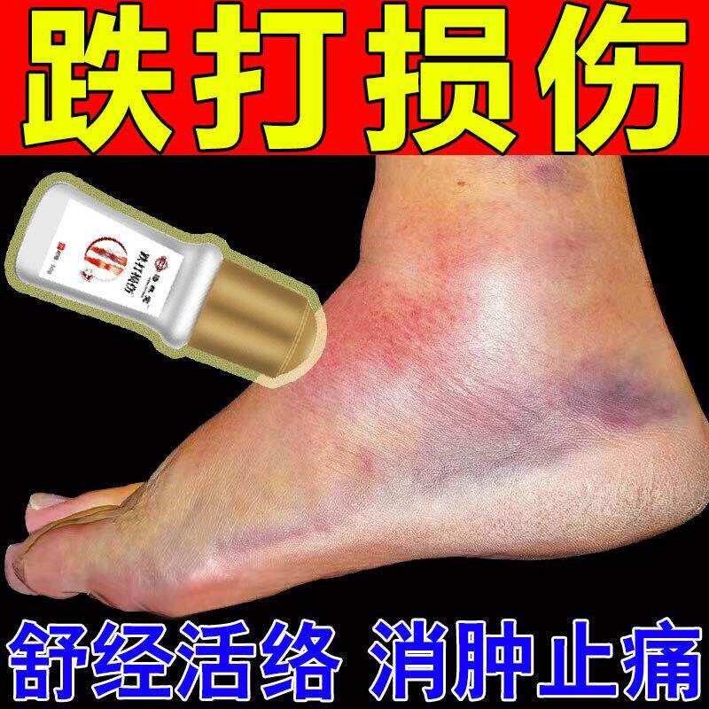 跌打损伤消肿止T痛脚踝扭伤骨折膝盖韧带拉伤活血化瘀肌肉理疗专