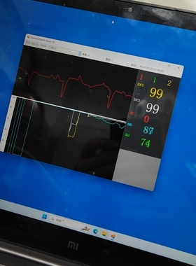 脑电模块-测量意识疼痛肌松麻醉深度等各项指标