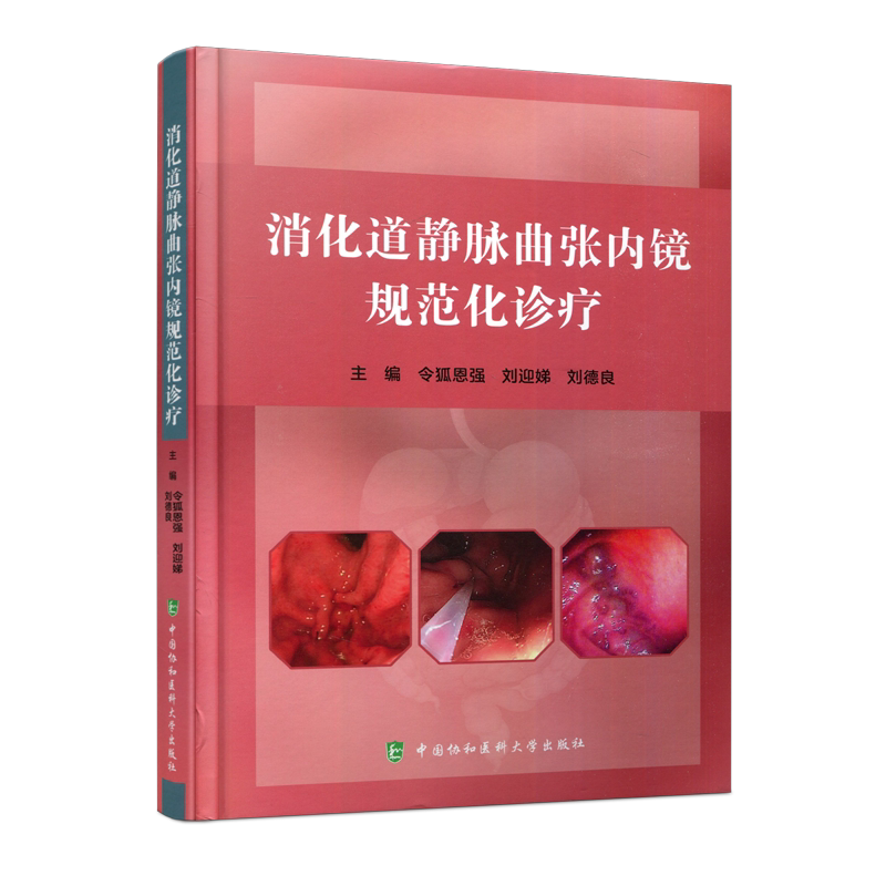 消化道静脉曲张内镜规范化诊疗