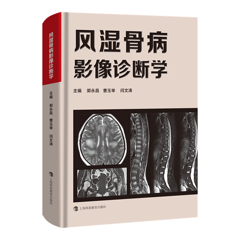 风湿骨病影像诊断学