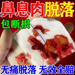 鼻腔息肉鼻塞专用药鼻子堵塞肿大不通气鼻干燥过敏鼻痒鼻炎一喷灵