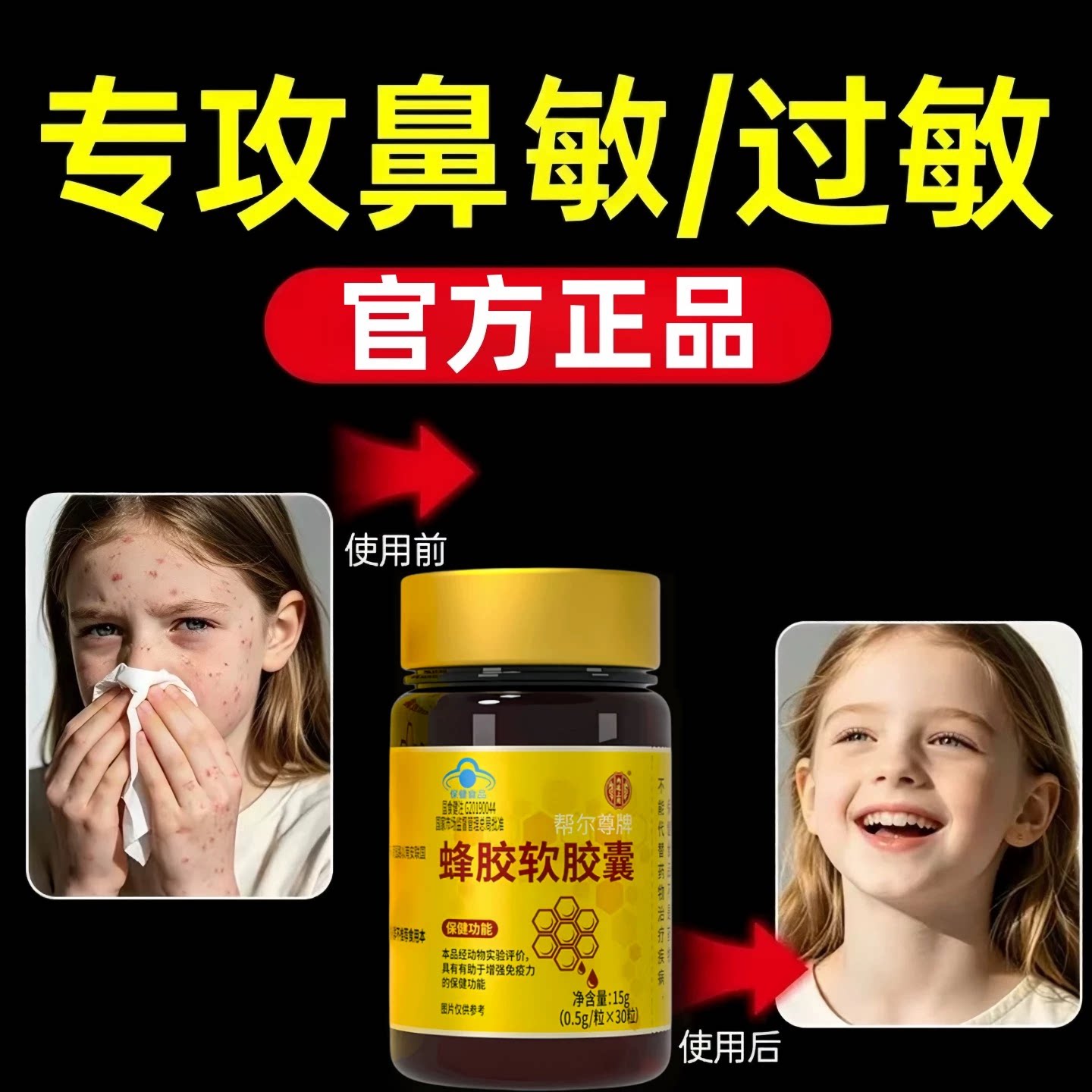 蜂胶软胶囊免疫调节提高自护力改善体质增强抵御力鼻敏鼻痒