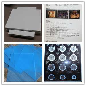 医用胶片B5x光蓝色喷墨医院用打印胶片x射线A4特价高清干式胶片