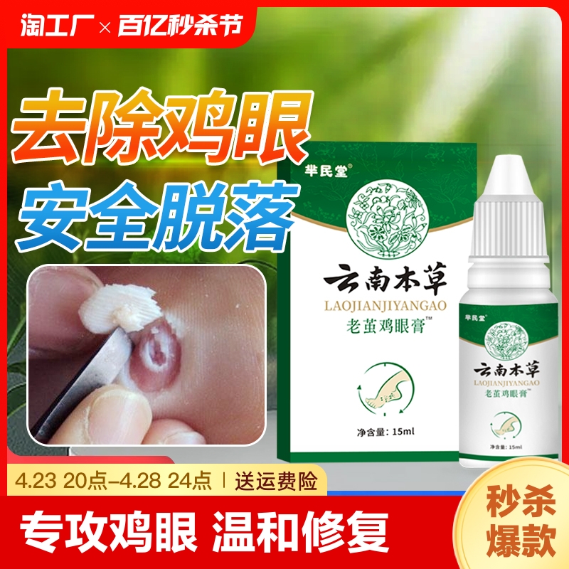 云南本草老茧鸡眼膏贴去脚底肉刺鸡眼贴鸡眼膏去除液角质草本修复