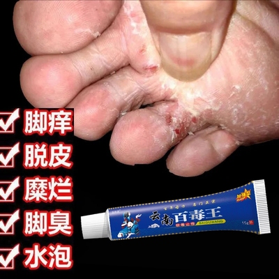苗药百毒王药膏旗舰店抑菌奇草去气脚水泡皮肤止痒膏脚丫子痒烂脚