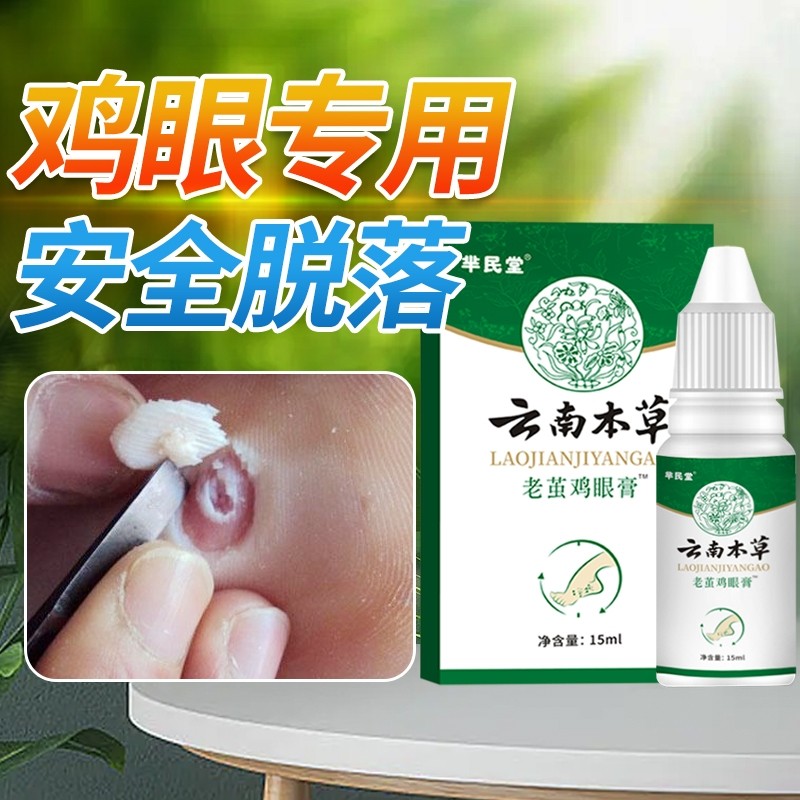 抑菌云南本草老茧鸡眼膏贴鸡眼贴正品去脚底肉刺鸡眼膏去除液草本