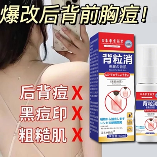 背粒消去祛痘后背除螨前胸去背上胸口屁股痘去除祛痘喷雾螨虫痘印