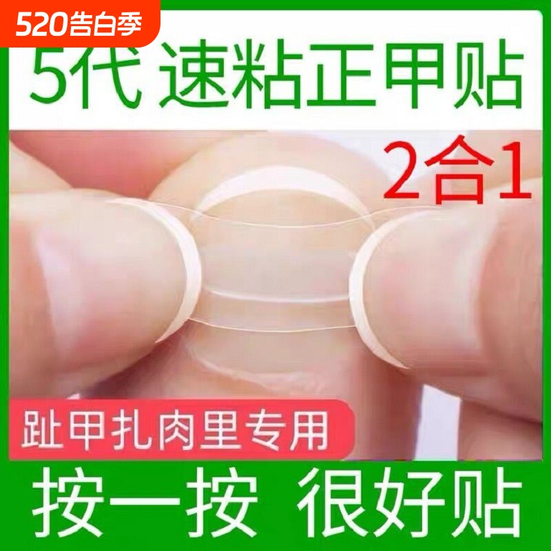 甲沟矫正器指甲矫正甲贴片纠正趾甲往肉里长嵌甲校正器修脚刀胶布