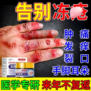 冻疮膏止痒冻伤膏儿童医用凡士林软膏排行榜第一名正品官方旗舰店