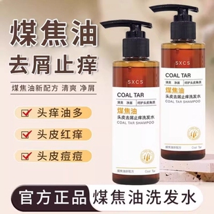 煤焦油洗剂洗发水去屑止痒脂溢性皮炎抑制马拉色菌洗头水控油蓬松