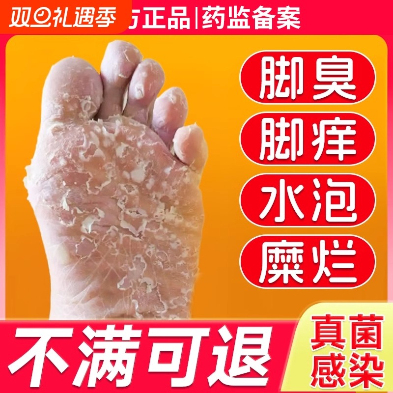 脚气喷雾止脱皮痒杀菌真菌感染专用臭脚痒出汗脚泡脚根趾缝糜烂痒