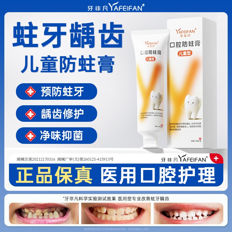 牙非凡儿童口腔防蛀膏防龋齿固齿封闭牙窝沟点隙牙菌斑牙膏s修复