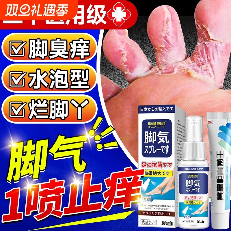 脚止痒气脱皮杀菌脚痒水泡烂脚丫真菌喷雾膏药糜烂趾缝烂痒非特效