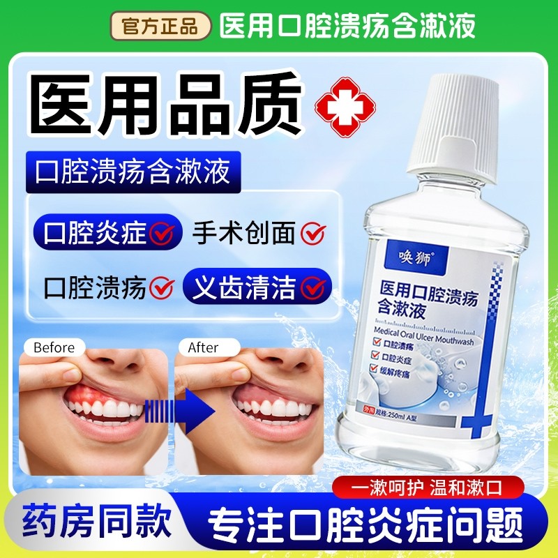 医用漱口水口腔溃疡含漱液口腔炎症牙龈出血义齿手术创面缓解疼痛